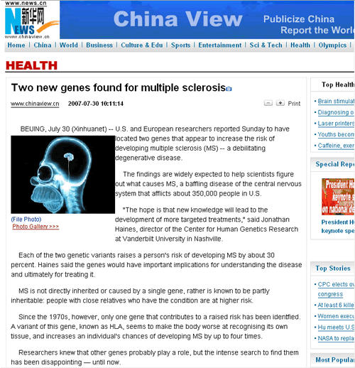 Small screenshot of China View article featuring Homer Simpson’s head x-ray